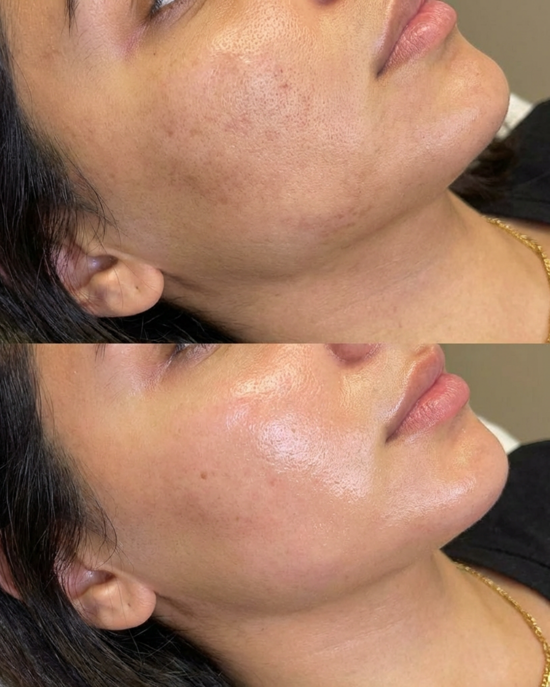 Before and after: Cellular Hydration